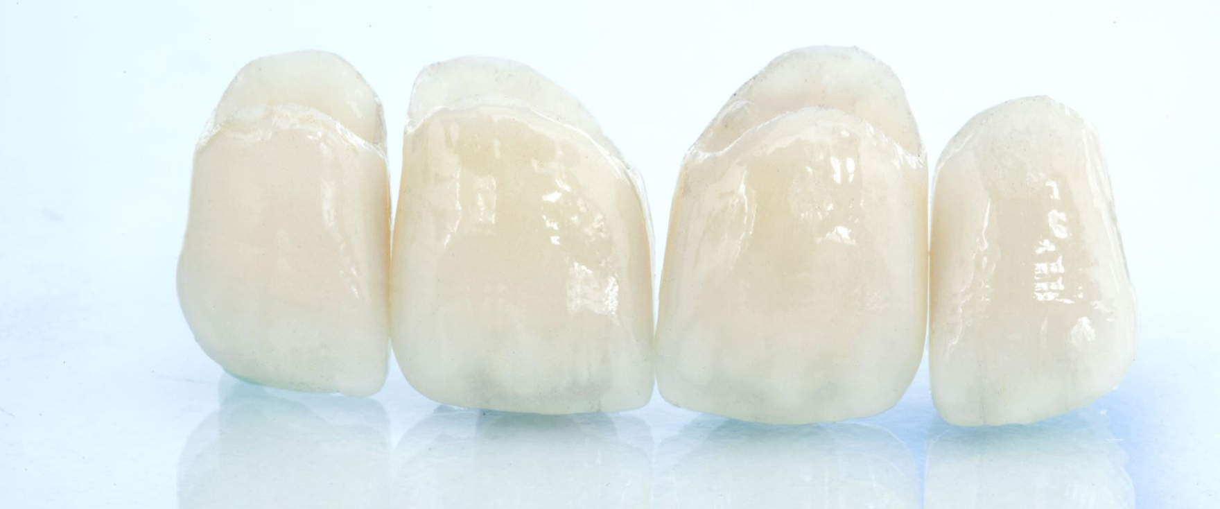 つめ物・かぶせ物